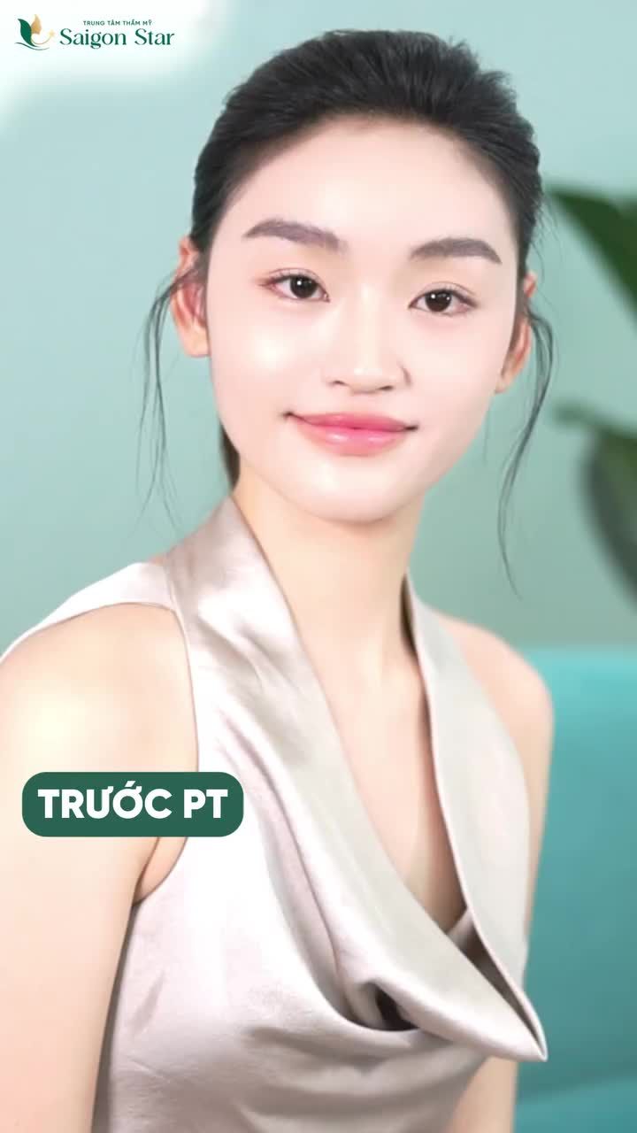 SAU 6 THÁNG QUYẾT ĐỊNH NÂNG MŨI + NÂNG VÒNG 1 HOA HẬU YẾN NHI NHẬN ĐƯỢC ĐIỀU GÌ????