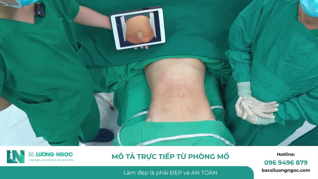 SAU 2 LẦN SINH – TỪ BỤNG NHĂN, SỆ NHẸ, HÔNG PHÌNH ĐẾN VÓC DÁNG GỌN GÀNG, CÂN ĐỐI HƠN