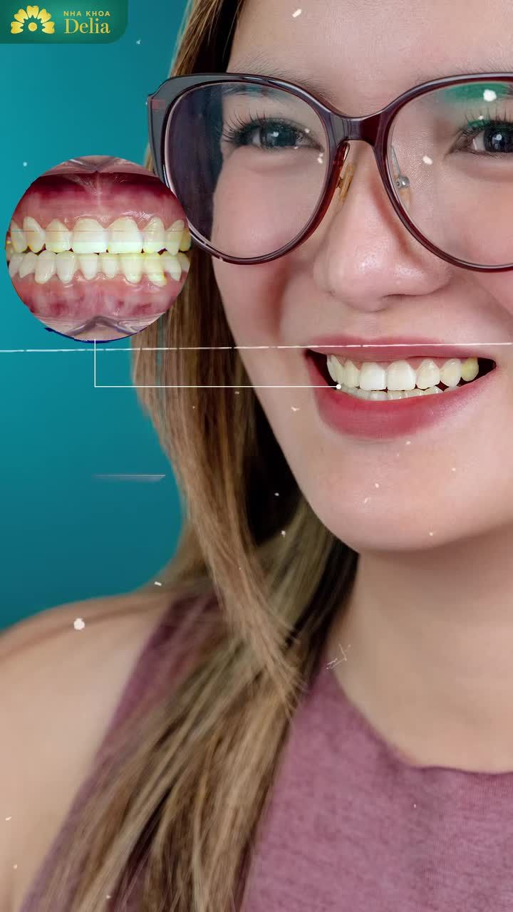 KHỞI ĐẦU TUẦN MỚI BẰNG NỤ CƯỜI TỰ TIN