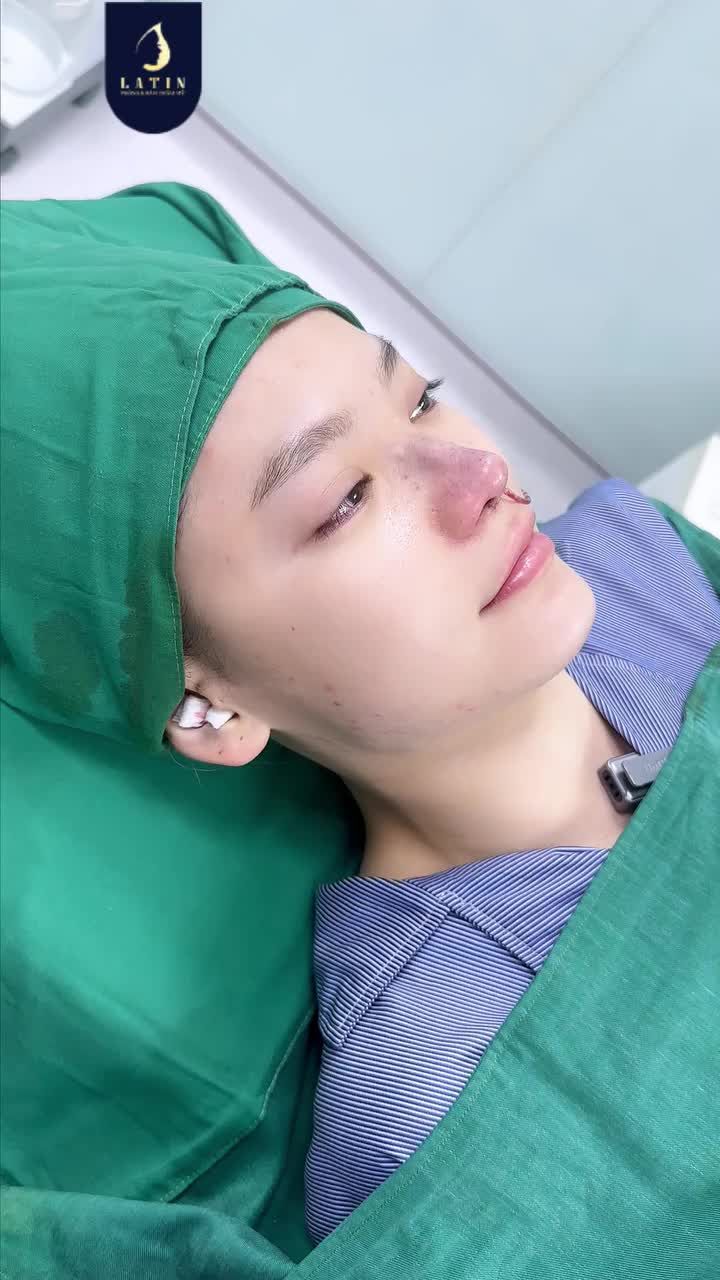 THU ĐẦU MŨI – THU NỀN MŨI | GIỮ NGUYÊN DÁNG, GỌN GÀNG HƠN