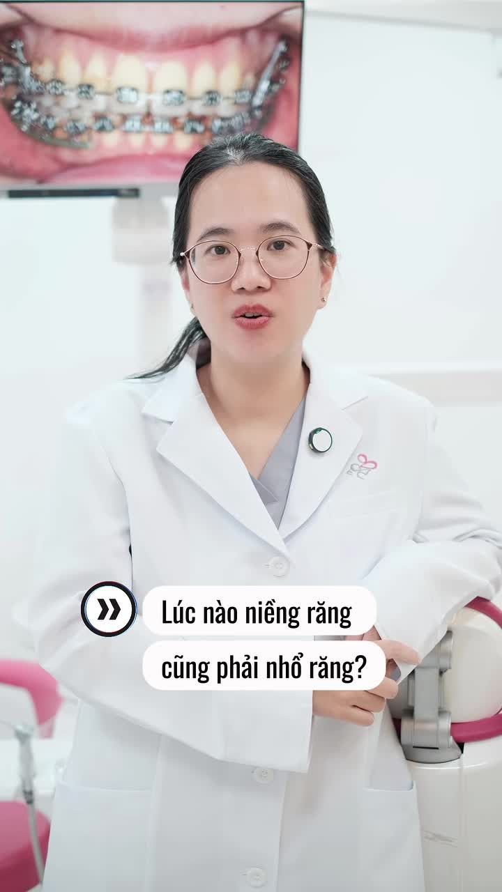 TRƯỜNG HỢP NÀO CẦN NHỔ RĂNG KHI NIỀNG?