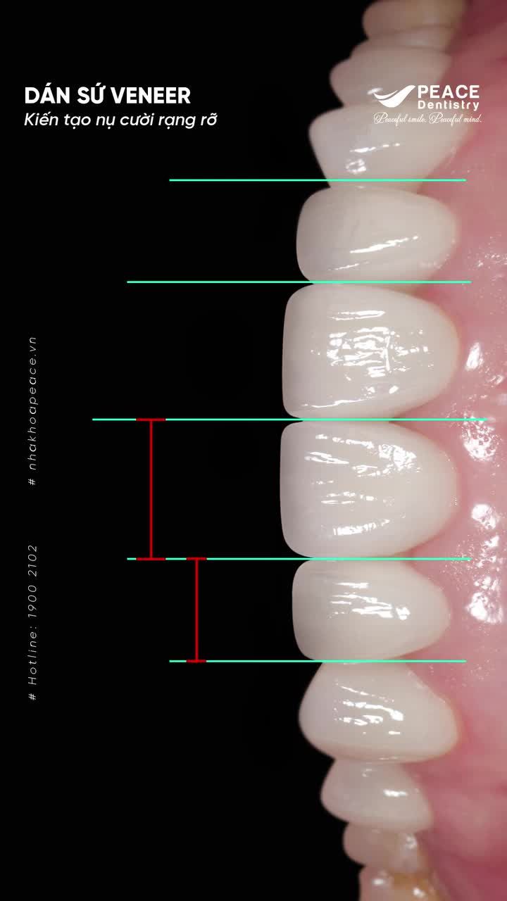 NỤ CƯỜI LÀ "TẤM DANH THIẾP" ĐẮT GIÁ NHẤT CỦA BẠN