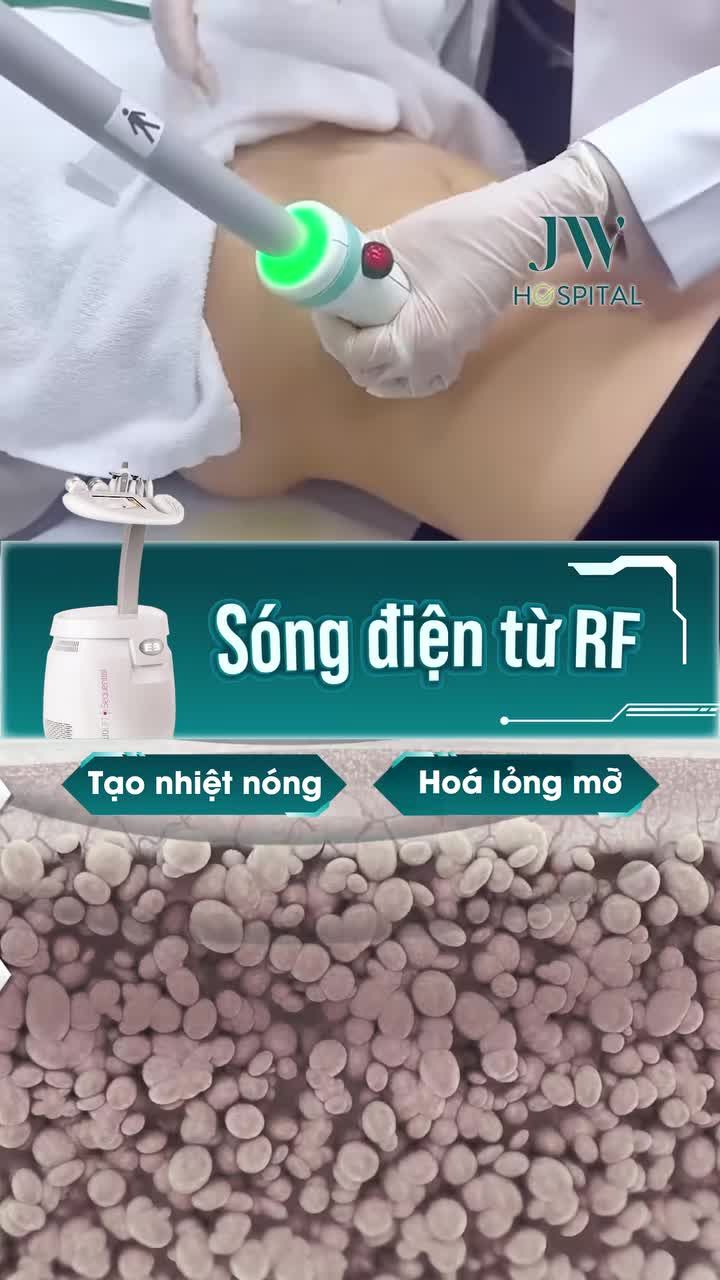 EO THON, DÁNG GỌN KHÔNG PHẪU THUẬT VỚI CÔNG NGHỆ GIẢM M.Ỡ BẰNG SÓNG ĐIỆN TỪ RF TẠI JW