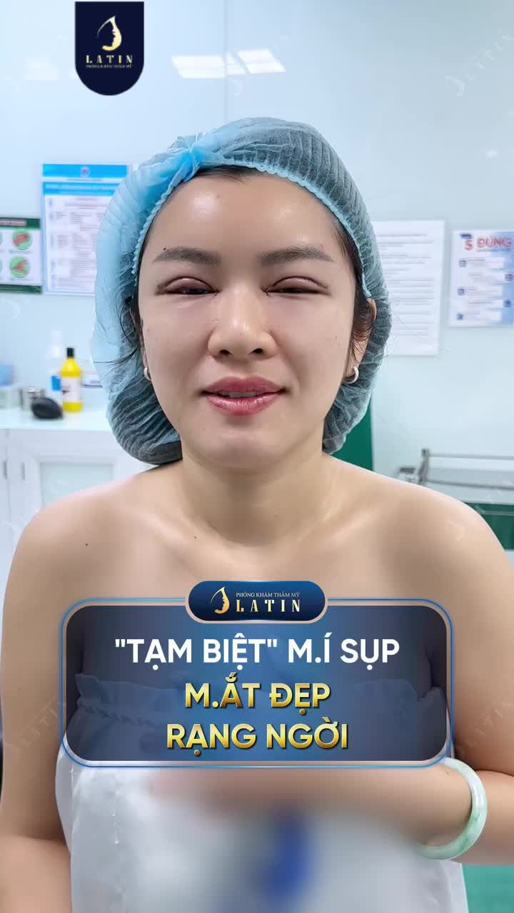 "TẠM BIỆT" MÍ SỤP, MẮT ĐẸP RẠNG NGỜI