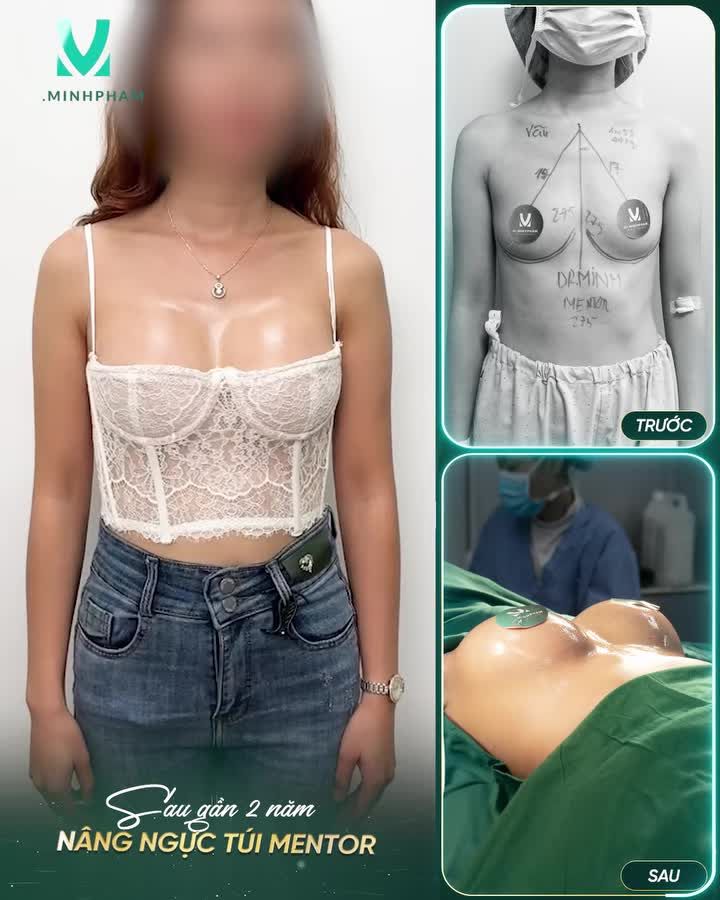 VẺ ĐẸP BỀN VỮNG THEO THỜI GIAN