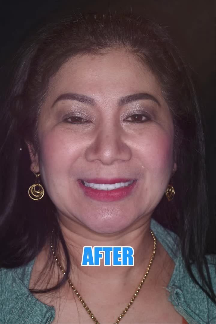 PHỤC HỒI NỤ CƯỜI – TÌM LẠI SỰ TỰ TIN