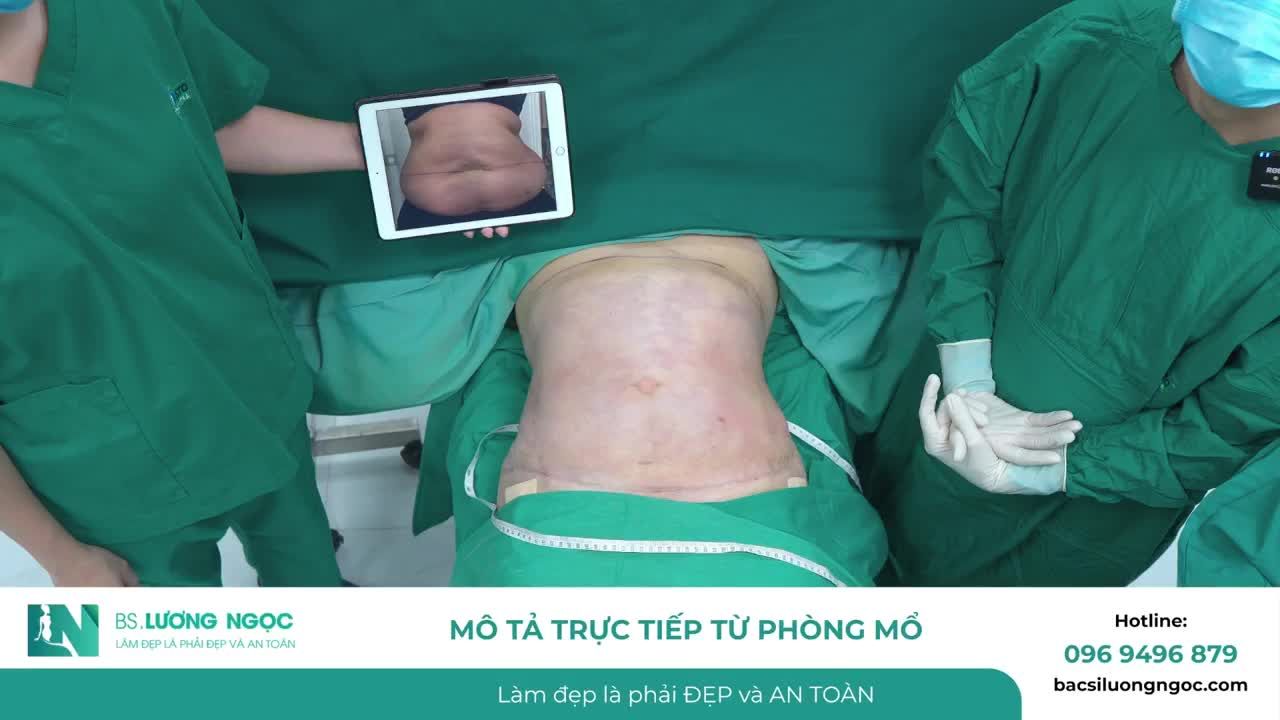 VÒNG BỤNG 1M2 GHI NHẬN THAY ĐỔI GẦN 30CM SAU 2 GIỜ THỰC HIỆN