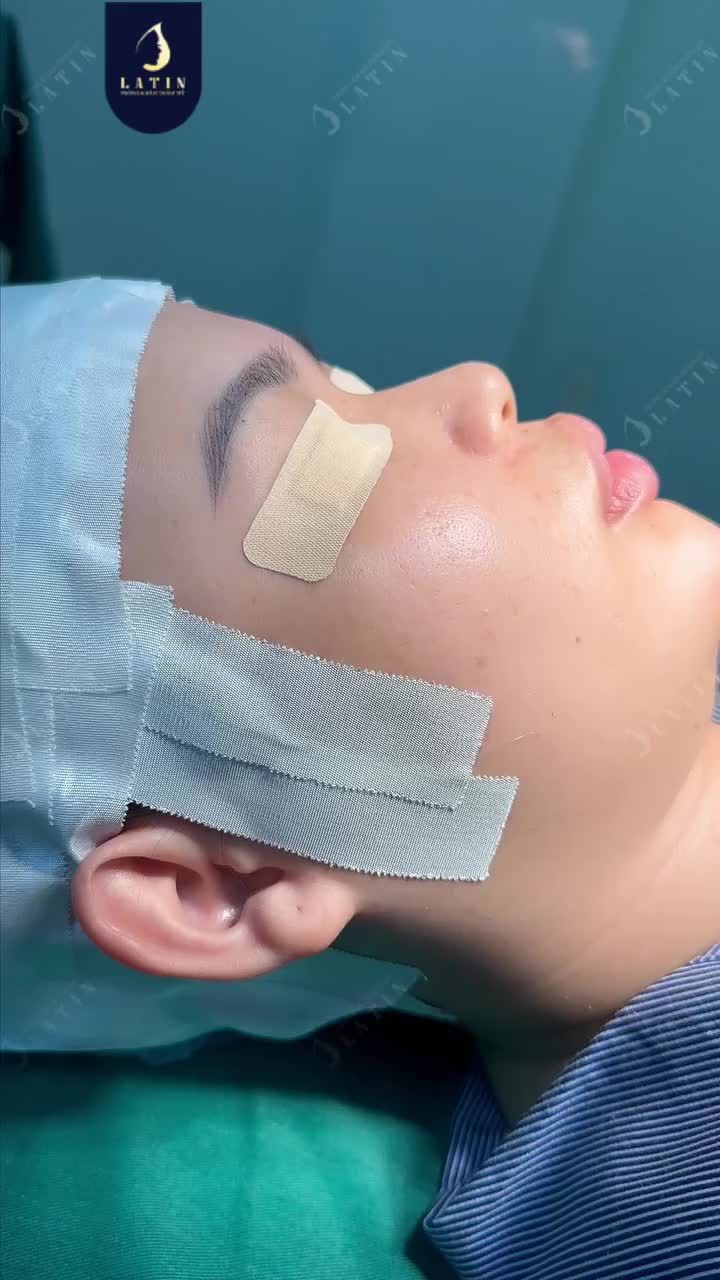 MỘT GÓC NGHIÊNG – HAI DIỆN MẠO