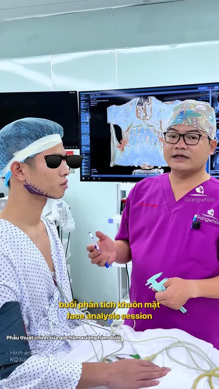 Bác sĩ trực tiếp phân tích tình trạng lệch xương hàm nghiêm trọng của khách hàng đến từ Trung Quốc.