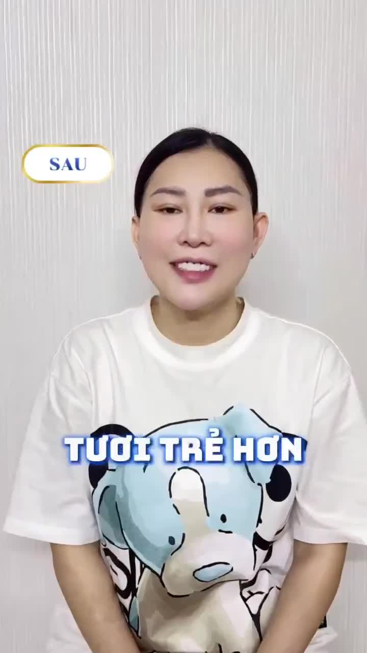 CĂNG DA MẶT CÓ ĐỂ LẠI SẸO KHÔNG? LẮNG NGHE CHIA SẺ THỰC TẾ!