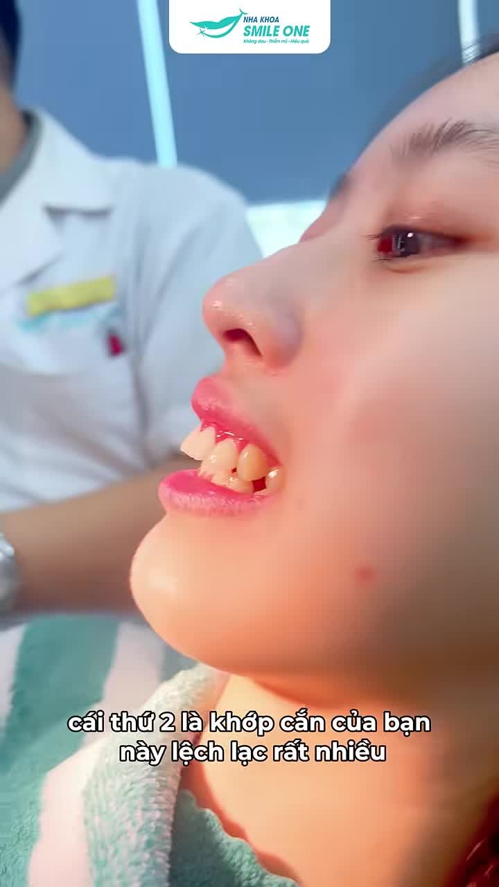 NIỀNG RĂNG SAI NƠI - MẤT NHIỀU HƠN ĐƯỢC