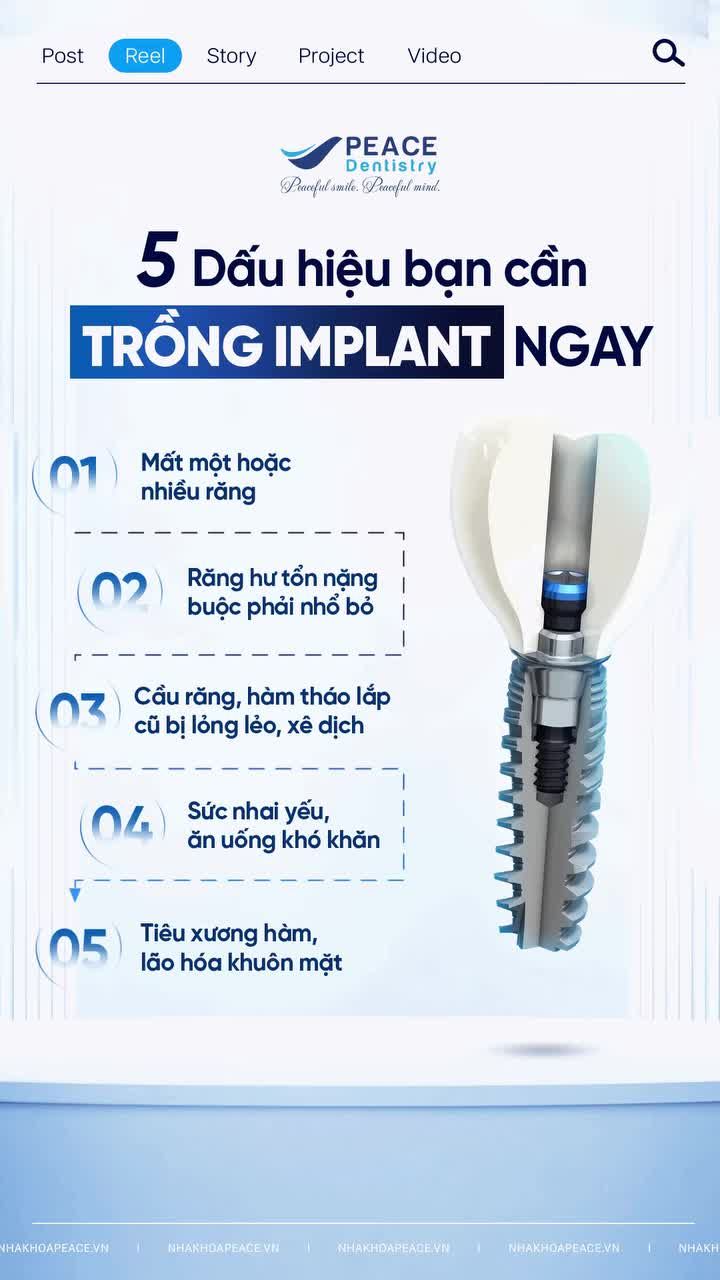 Mất răng lâu ngày không chỉ gây hóp má, lão hóa nhanh mà còn ảnh hưởng trực tiếp đến dạ dày khi sức nhai yếu và ăn uống trở nên khó khăn.