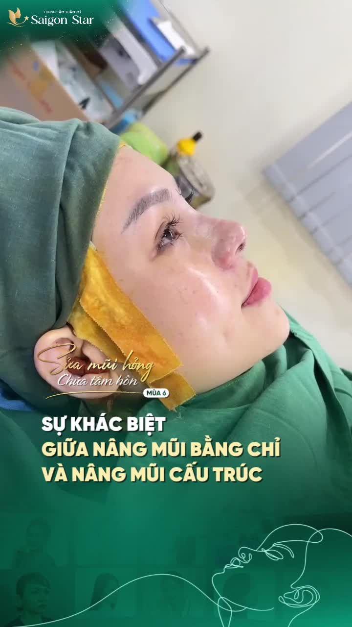 SỰ KHÁC BIỆT GIỮA NÂNG MŨI BẰNG CHỈ VÀ NÂNG MŨI CẤU TRÚC DR. HOẠT