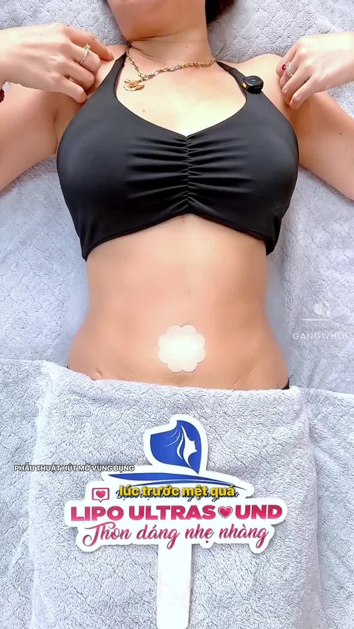 Kết quả giảm mỡ đạt trên sự kỳ vọng, chị khách U50 chia sẻ thú vị sau 1 tháng thực hiện