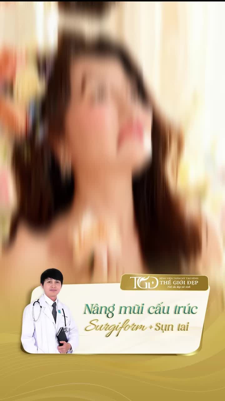 Nâng mũi cấu trúc sụn tai Surgiform - Lựa chọn lý tưởng cho Quý Cô yêu thích form mũi nhẹ nhàng, thanh thoát, tự nhiên