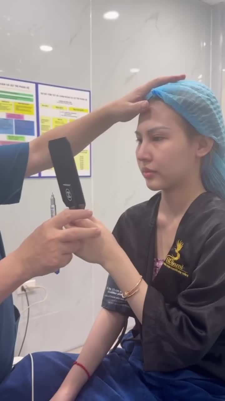 Tư vấn xoá rãnh lệ sâu mí dưới mở góc mắt trong