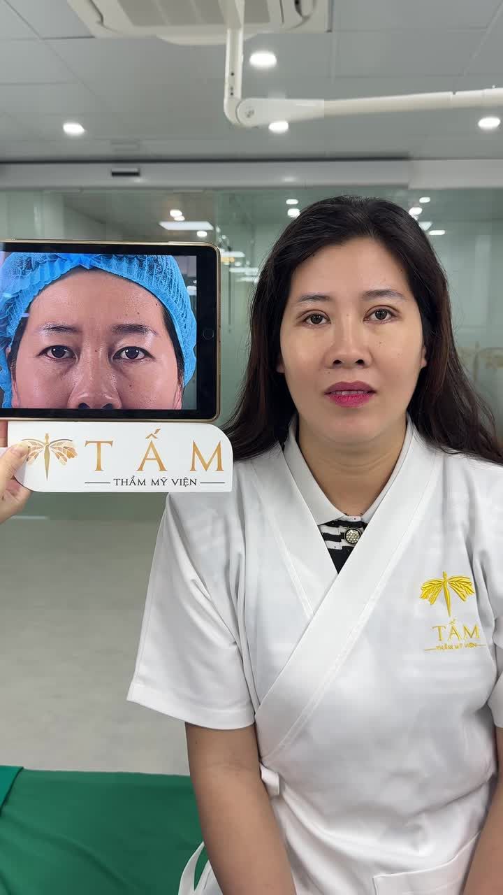 Hình ảnh khách hàng qua cắt chỉ sau 7 ngày thực hiện