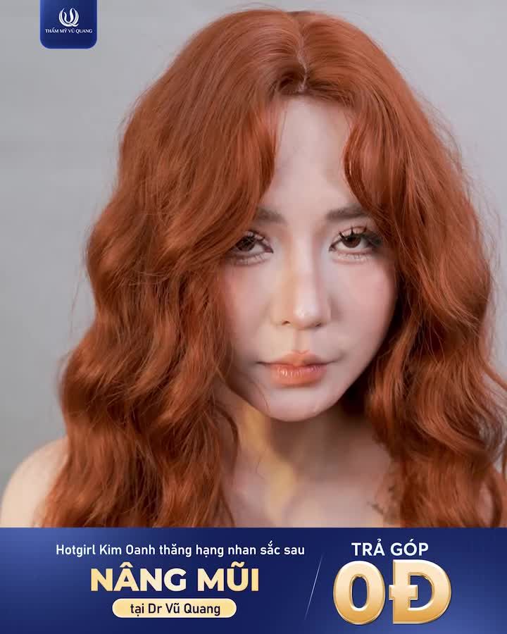 ĐỪNG NÂNG MŨI ....NẾU NHƯ BẠN KHÔNG MUỐN TRỞ NÊN QUÁ XINH ĐẸP