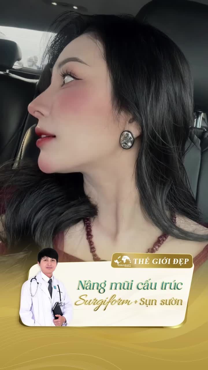 Vì sao cùng là nâng mũi cấu trúc nhưng mỗi người lại có một dáng mũi khác nhau?