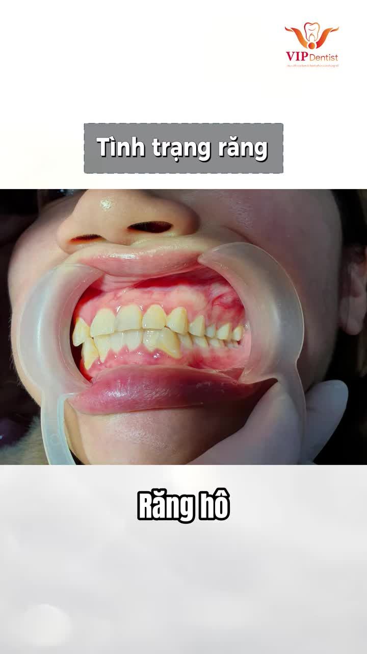 ĐÁNH THỨC NỤ CƯỜI RẠNG RỠ – HÀNH TRÌNH THAY ĐỔI CỦA CHỊ THANH HƯƠNG