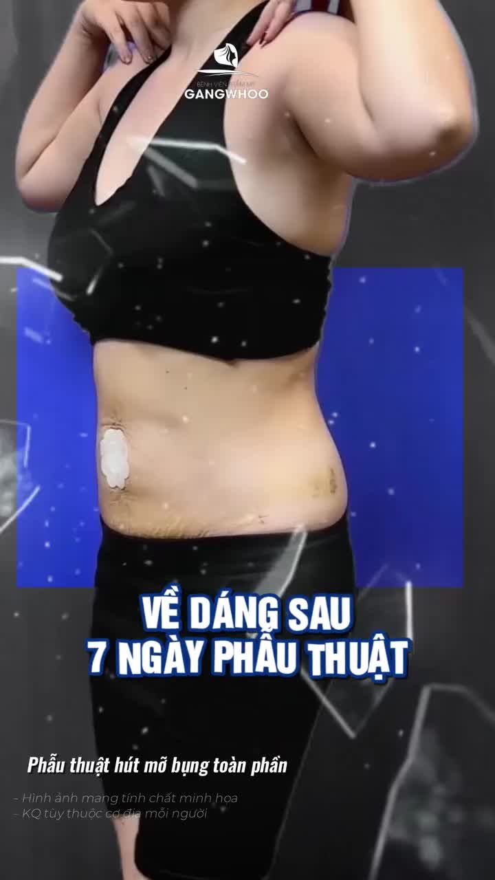 Nghe lời bạn đi giảm mỡ ở Gangwhoo và cái kết không thể "ngọt ngào" hơn