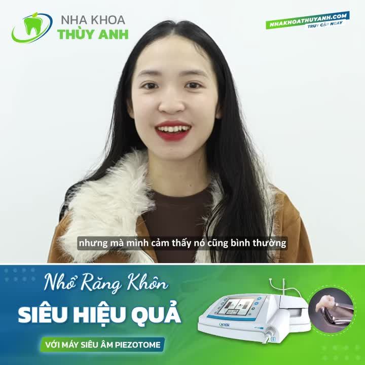 NHỔ RĂNG KHÔN SẼ BỊ NGU ĐI - REVIEW TỪ NGƯỜI KHÁC VÀ TRẢI NGHIỆM THỰC TẾ CỦA THẢO NGUYÊN