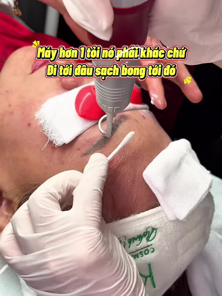 Chân mày xăm lỗi… muốn xoá nhưng lại sợ đau?