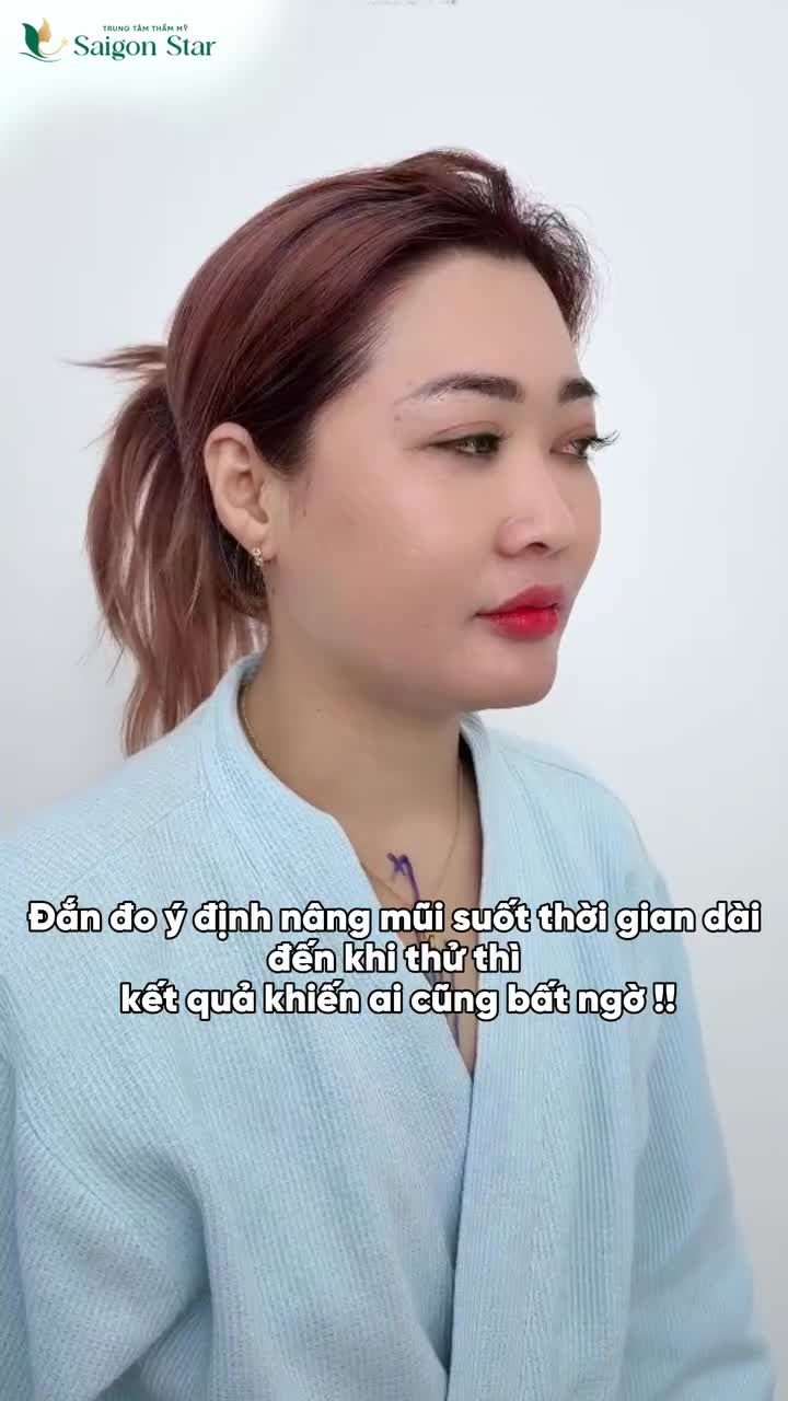 NÂNG MŨI NÂNG CẤP NHAN SẮC