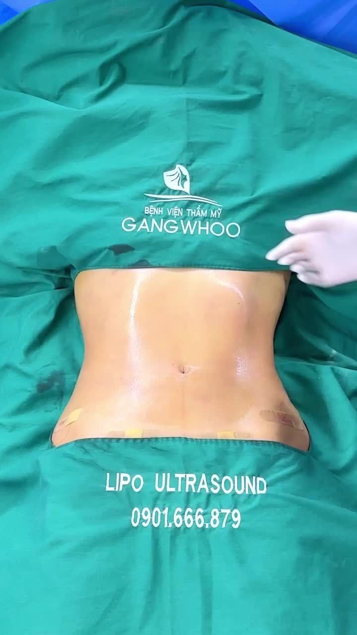 HÀNH TRÌNH CẢI THIỆN VÓC DÁNG SAU SINH