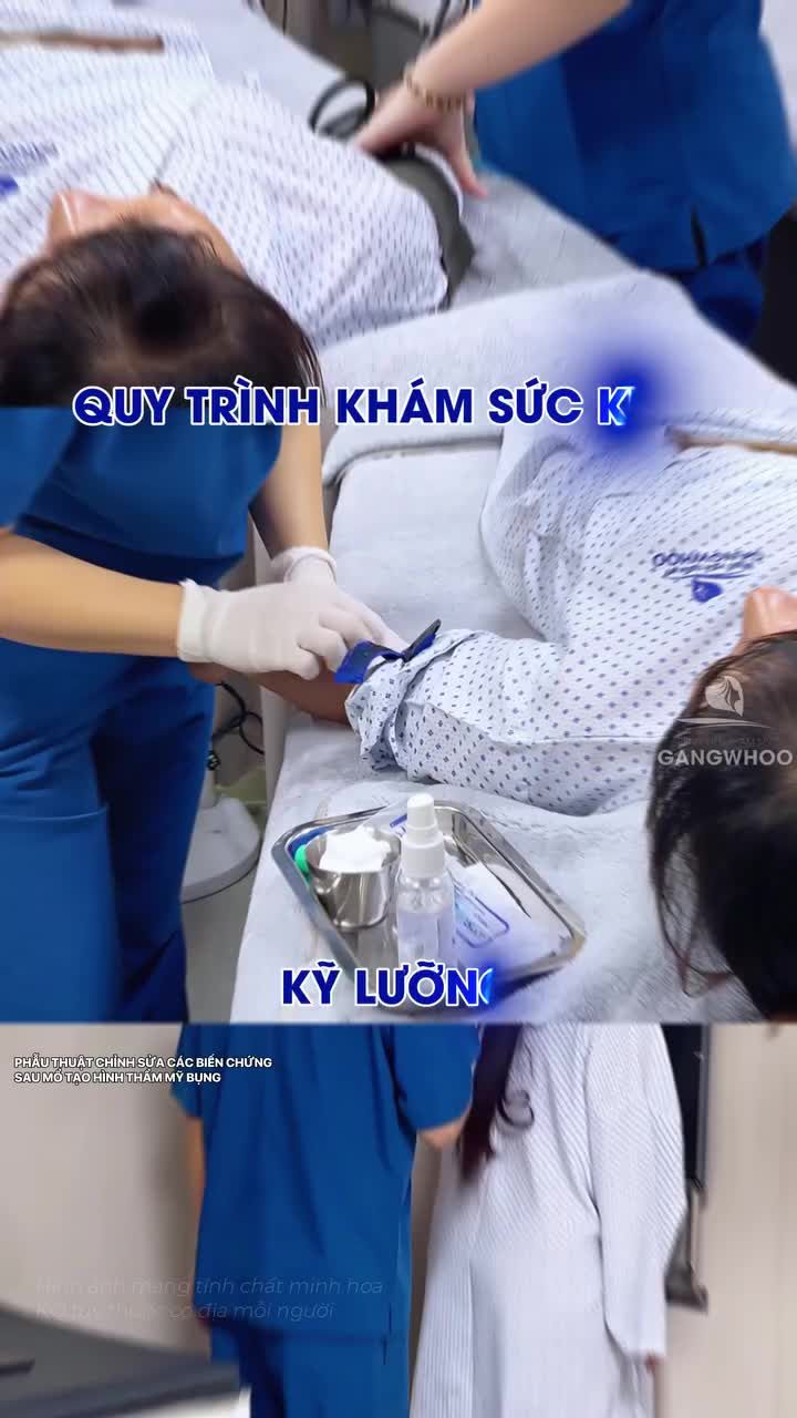 Sửa lại vòng 2 cho chị khách sau 2 năm giảm mỡ và căng da bụng nơi khác
