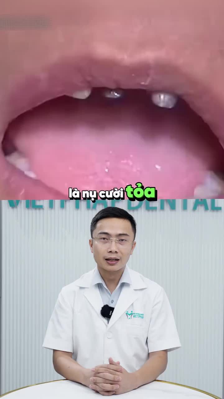 CÁI GIÁ PHẢI TRẢ KHI CHỌN RĂNG SỨ GIÁ RẺ