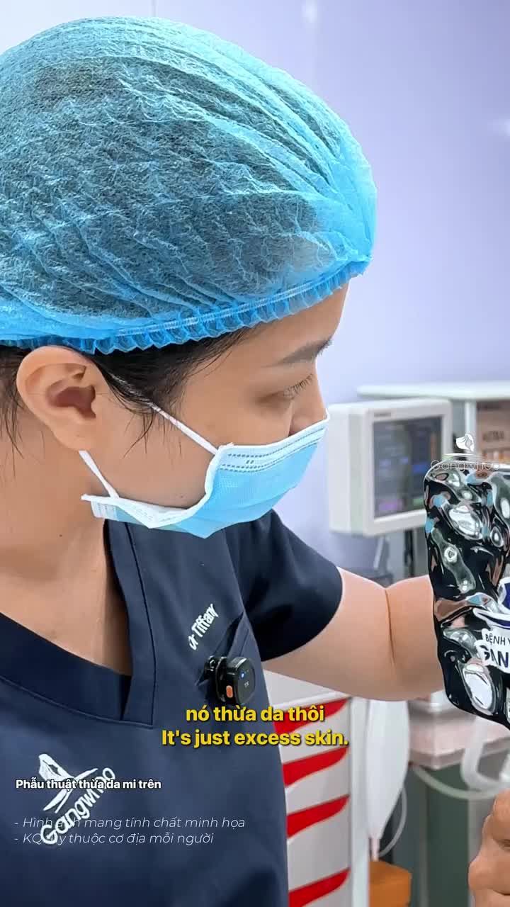 Chỉ cần loại bỏ da chùng, nếp mí nhìn rõ nét giúp đôi mắt trẻ trung hơn. Quá trình thực hiện nhanh chóng, chỉ khoảng 45 phút và hoàn toàn không gây đau