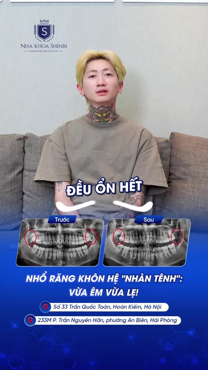 "CHẠM VÀO CÁI LÀ XONG!" - CHIA SẺ VỀ CA NHỔ 2 RĂNG KHÔN CỰC ÊM TẠI NHA KHOA SHINBI