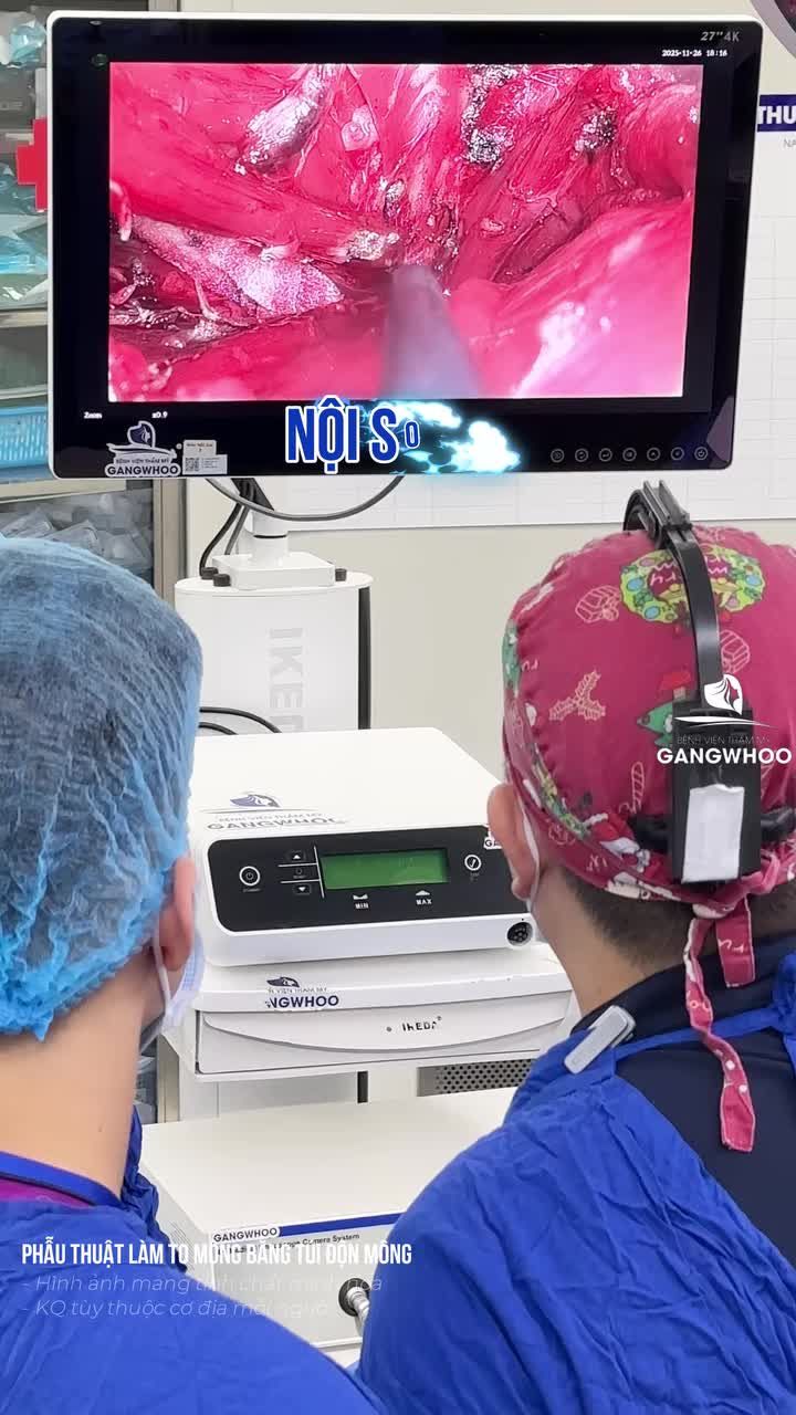 Biến hóa "hồng khô" thành "đào tròn" chỉ sau 60 phút không đau nhờ công nghệ nội soi 4K