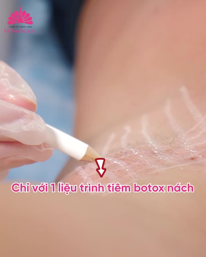 CHỈ SAU 15 PHÚT: TẠM BIỆT HÔI NÁCH - THOẢI MÁI VẬN ĐỘNG, TỰ TIN SUỐT NGÀY DÀI