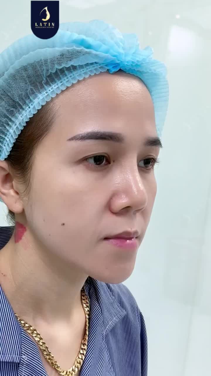 45 PHÚT SỬA LẠI MÍ ĐÃ TỪNG CẮT