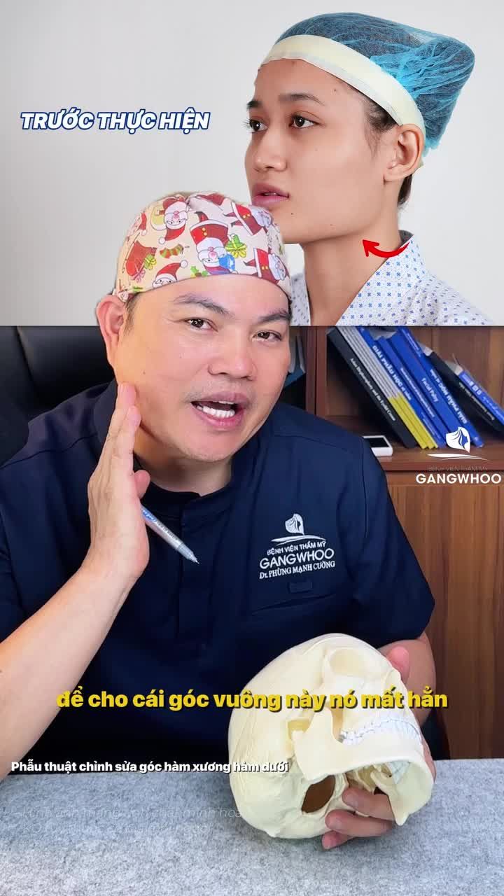 Cùng nghe bác sĩ phân tích chi tiết về phương pháp gọt hàm nội soi 4K – giải pháp giúp chỉnh hình an toàn, hạn chế xâm lấn và mang lại đường nét gương mặt tự nhiên hài hòa hơn.