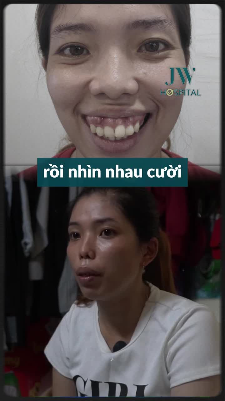 TỪ CÔ GÁI BỊ CHẾ GIỄU “NẠO DỪA” KHẮP XÓM – CÁI KẾT BẤT NGỜ SAU PHẪU THUẬT HÀM HÔ TẠI JW (P1)