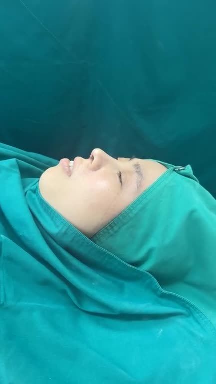 Mũi cấu trúc vừa hoàn thành
