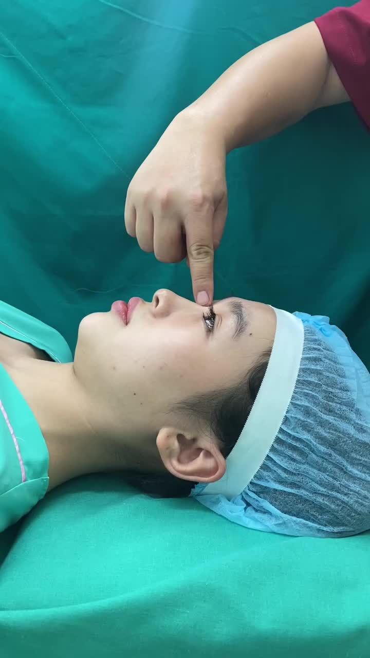 NÂNG MŨI CẤU TRÚC – DÁNG CAO TÂY CHO GƯƠNG MẶT SẮC NÉT