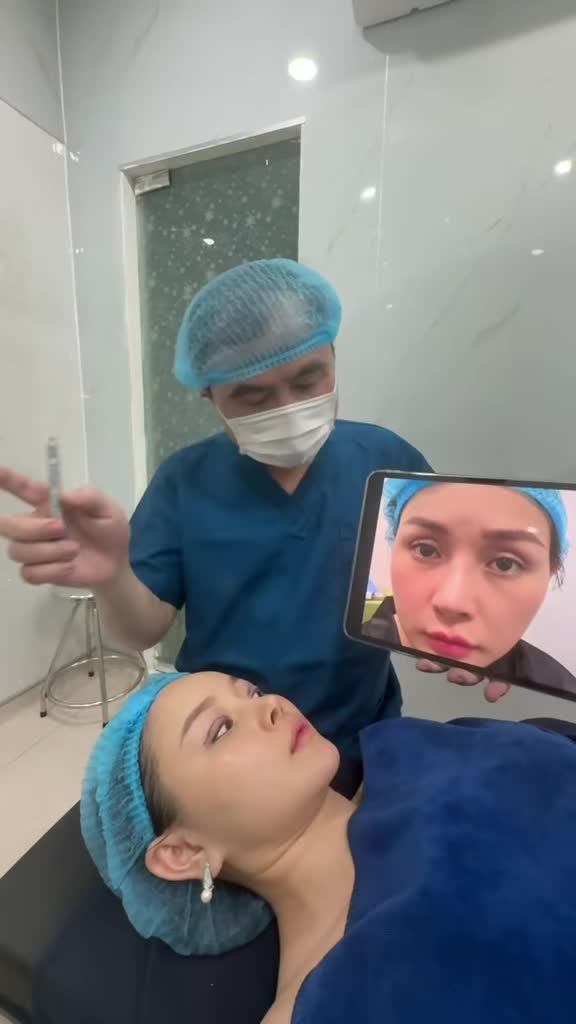 Sửa mí trên, hạ size mí bự xử trí mí lõm = ghép mỡ trung bì với Dr Vương