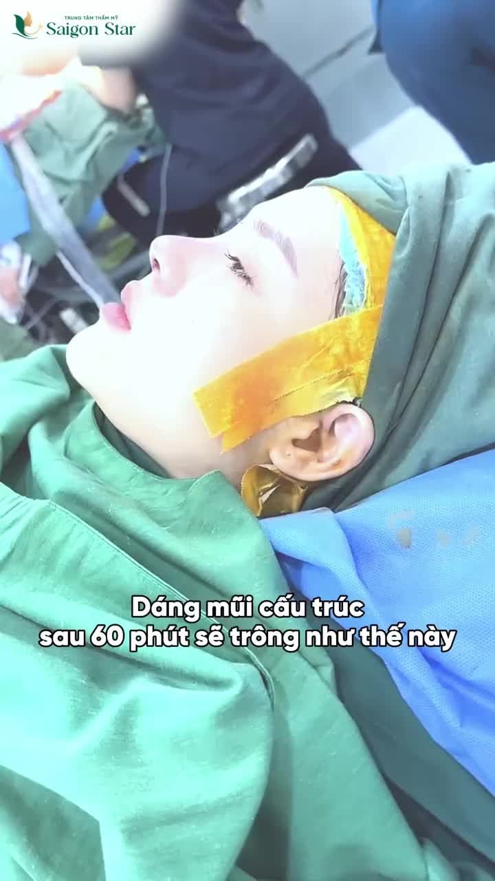 TÁI SINH ĐƯỜNG NÉT - HOÀN THIỆN DÁNG MŨI CHỈ SAU 60 PHÚT