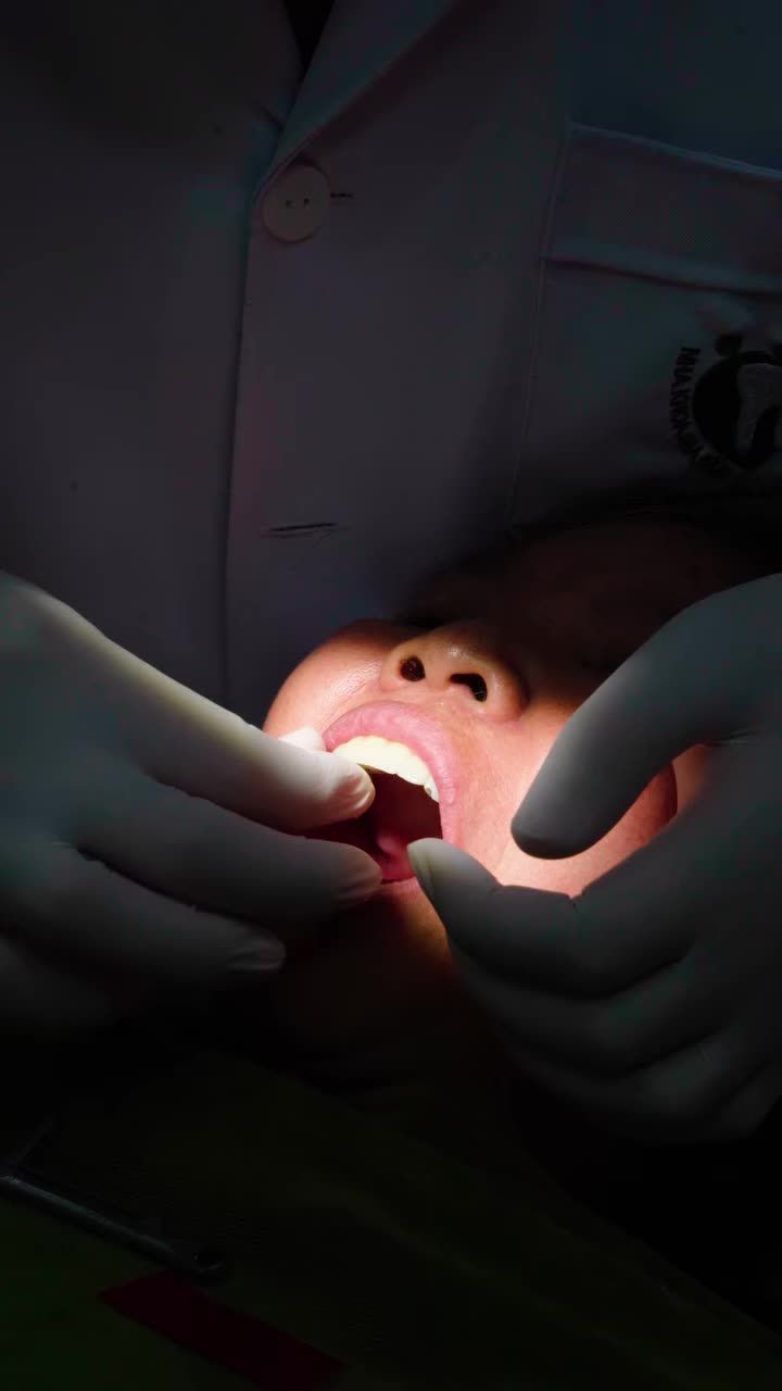 HOÀN TẤT LẮP RĂNG - KHÉP LẠI HÀNH TRÌNH CẤY GHÉP IMPLANT CHO CÔ LÊ THỊ XUYẾN