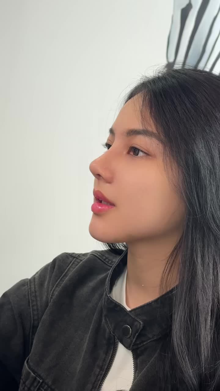 NÂNG MŨI + ĐỘN CẰM COMBO ''ĐÁNG TIỀN" ĐỂ SỞ HỮU GƯƠNG MẶT ĐẸP CHUẨN TỈ LỆ VÀNG!!