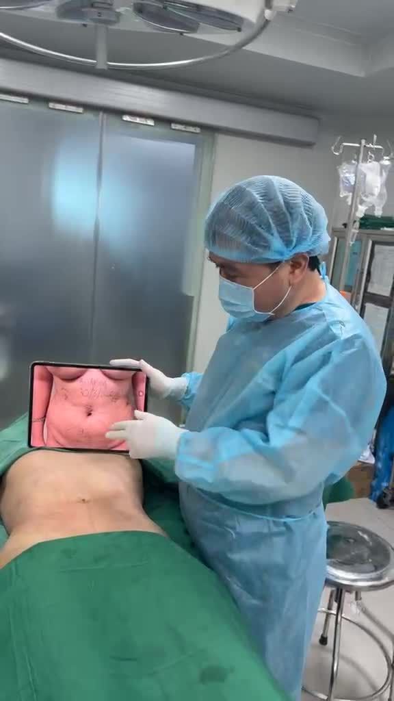 Hút mỡ bụng, đánh bay mọi tảng mỡ chắc với Dr Vương