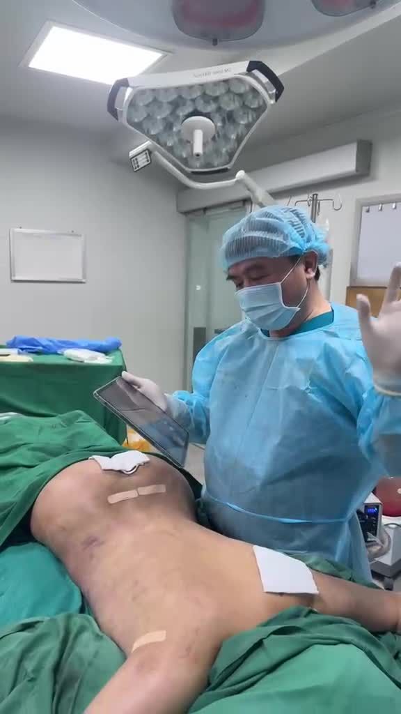 Xử trí triệt để, hiệu quả về mông lõm/hóp, hông eo khủng mỡ, mỡ lưng sa trễ, dư mỡ nách và cánh tay to/cong phồng … với Dr Vương