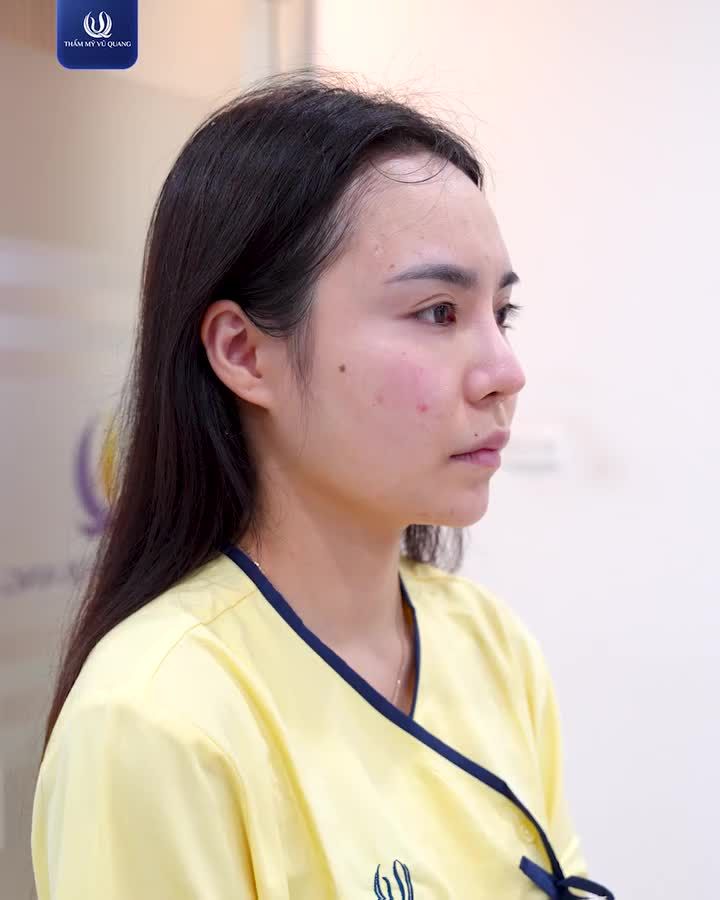 Những dáng mũi dự kiến sẽ "đốt cháy" mọi ánh nhìn trong mùa hè 2026.
