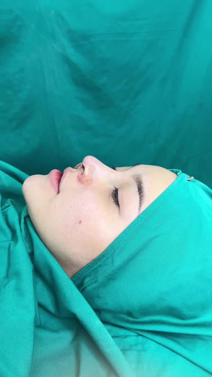 MŨI CẤU TRÚC SAU PHẪU THUẬT – SOI GƯƠNG CHỐT DÁNG NGAY TRÊN BÀN MỔ