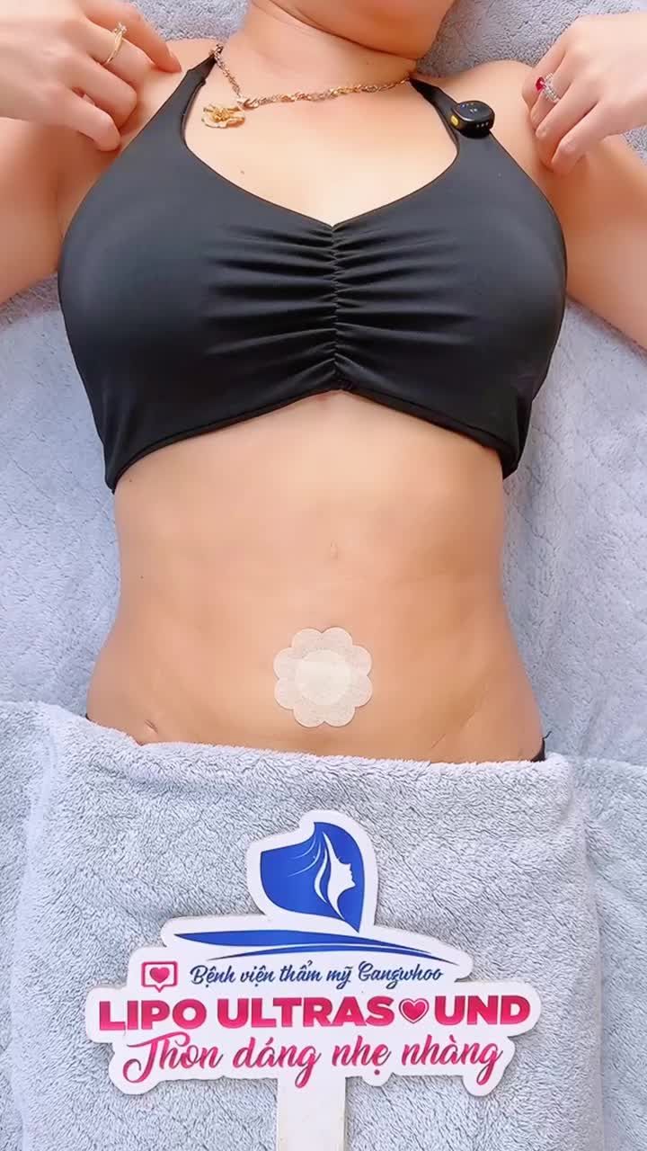 TÂM SỰ CÙNG KHÁCH HÀNG TÁI KHÁM LIPO: TÌM HIỂU KỸ, QUYẾT ĐỊNH ĐÚNG, ĐẸP TRỌN VẸN!