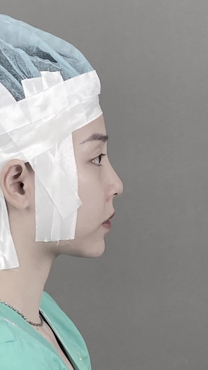 NÂNG MŨI CHỈ KHÔNG ƯNG Ý...CHỌN NÂNG MŨI CẤU TRÚC SỬA LẠI SURGIFORM ĐẸP XUẤT SẮC!!